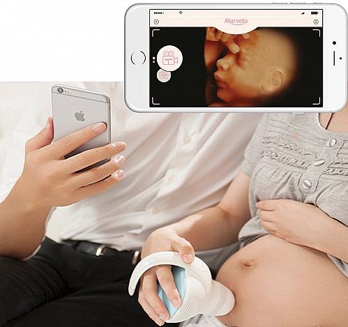 Marvoto帮孕妇随时给肚里的婴儿拍照