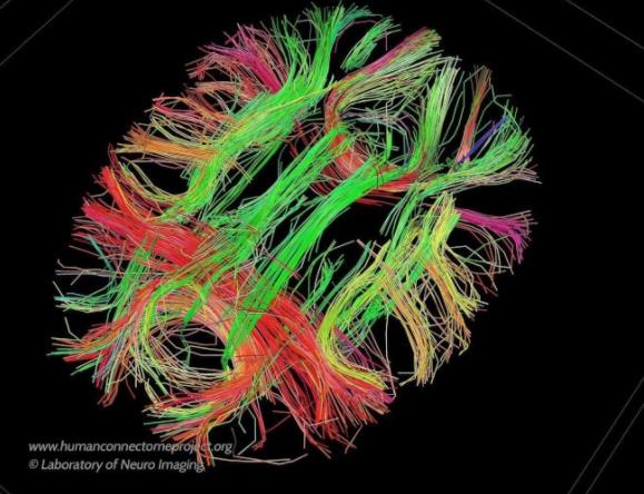 科学家研发新量子材料 未来可从云端“下载大脑”插图